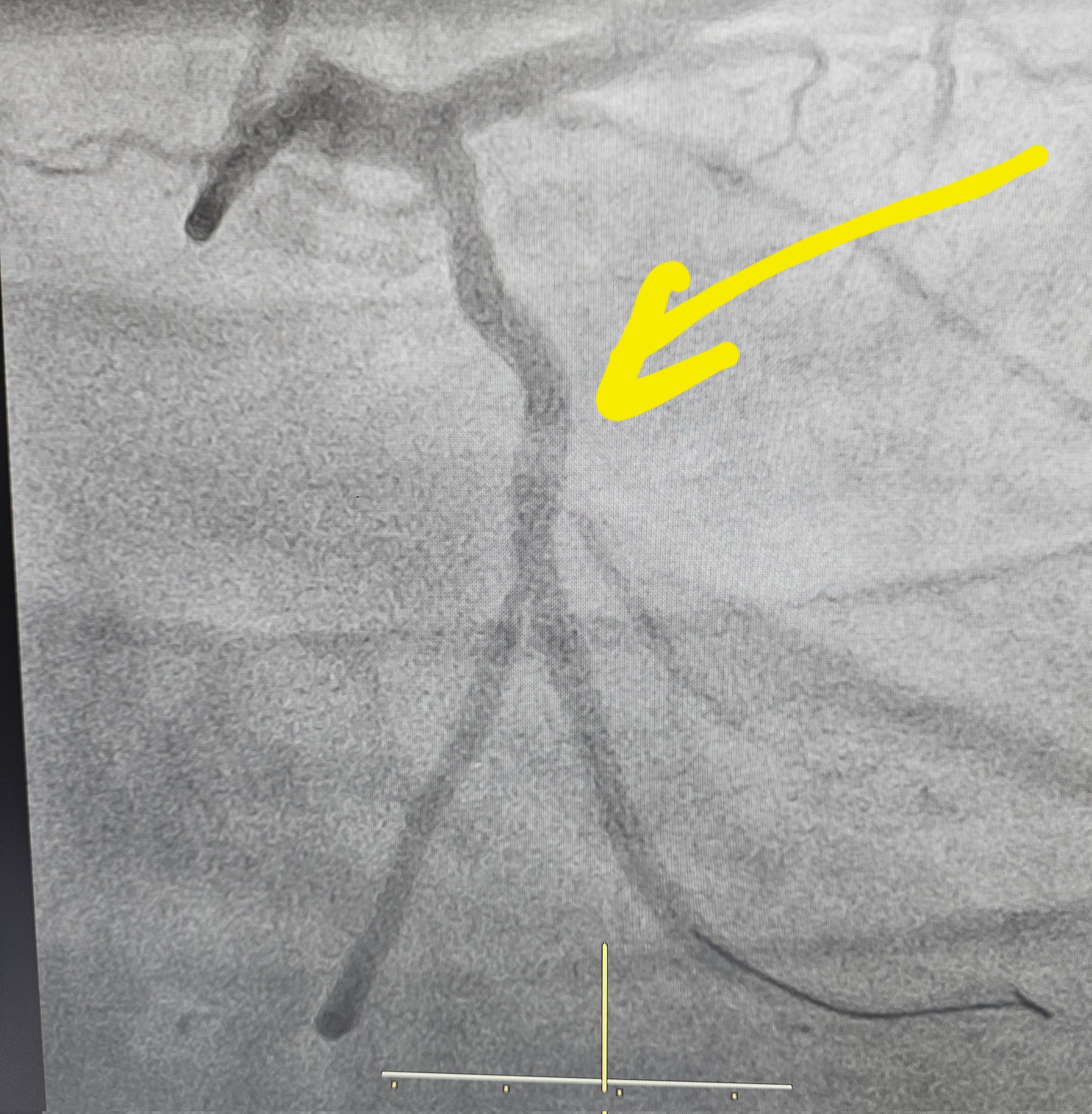 heartsurgery